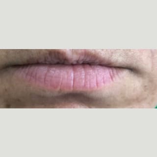 A close up of the lips and chin of a person