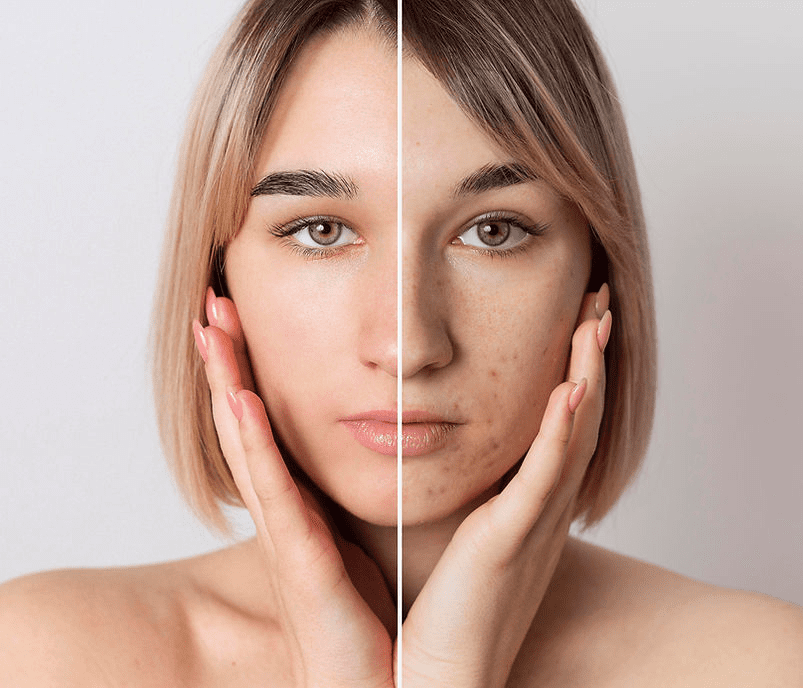 A woman with two different skin tones and one is white