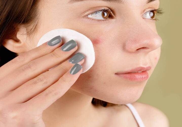 A woman is holding a cotton pad on her face.